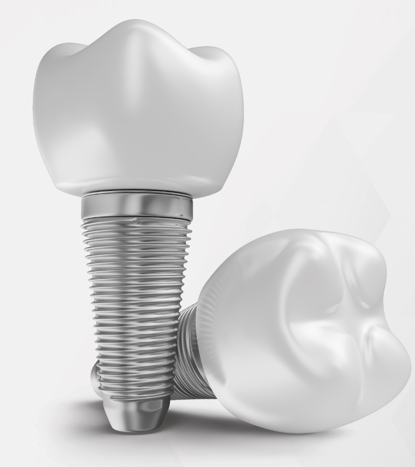 Representação de duas coroas sobre implantes odontológicos, extraída do material da marca
